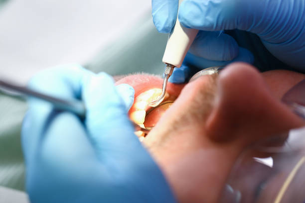 Best Tooth Infection Emergency Dentist  in Queensland, MD