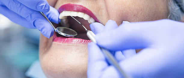 Best Chipped Tooth Repair Near Me  in Queensland, MD